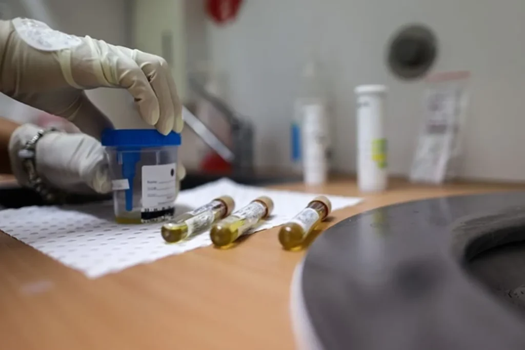 The Importance of Workplace Drug Testing Ensuring Safety and Productivity